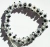 25 7mm Black & White Bumpy Glass Beads